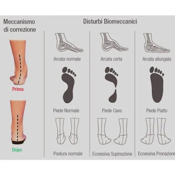 Solette Plantari per Correzione Piede Cavo - Scarpe Uomo e Donna